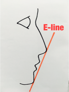 E-line（イーライン）