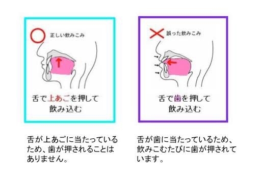 低位舌　舌　舌の正しい位置