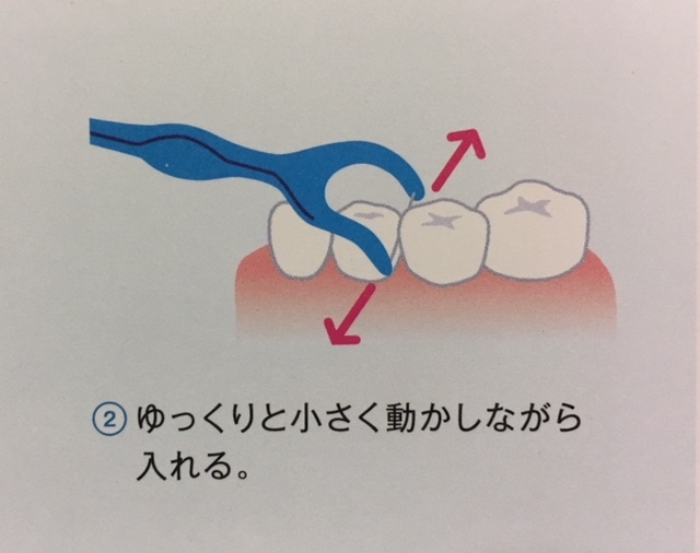 デンタルフロスの正しい使い方を（小学生向け）