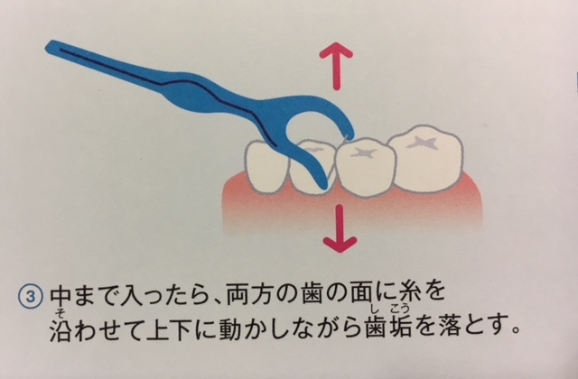 デンタルフロスの正しい使い方を（小学生向け）