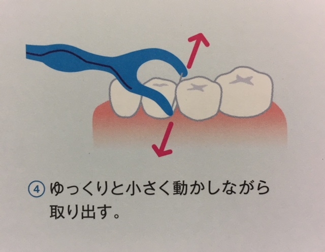 デンタルフロスの正しい使い方を（小学生向け）