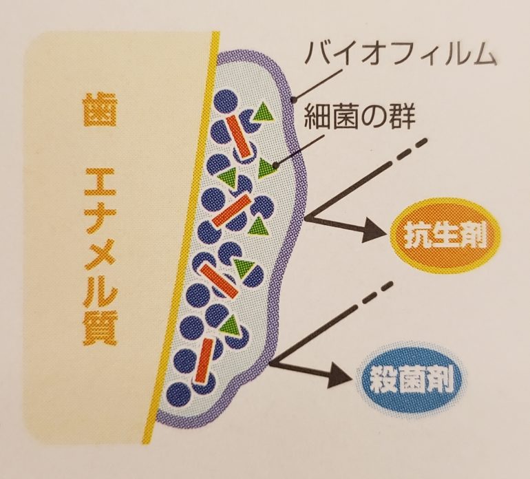 バイオフィルムの繁殖　PMTC　芦屋川聖栄歯科医院・矯正歯科