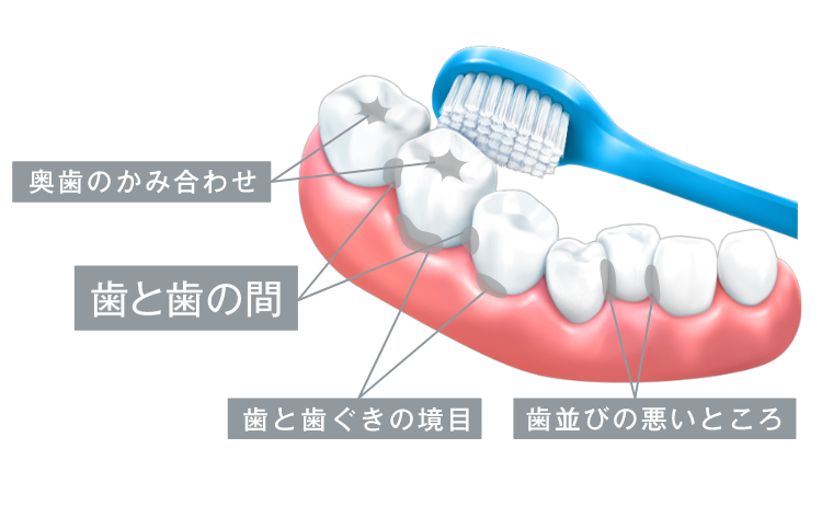 歯磨き　歯みがき　歯の磨き残し